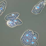 خلايا الغشاء المخاطي البشري في بطانة الفم