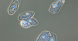 خلايا الغشاء المخاطي البشري في بطانة الفم