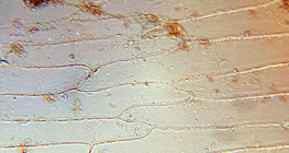 خلايا الأوراق الحرشفية اللحمية للبصلة