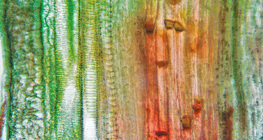 مقطع طولي في نسيج وعائي نباتي (جذع القرع)