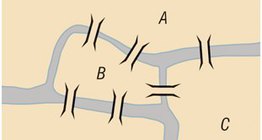 جسور كونيغسبرغ السبعة