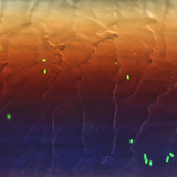 بكتريا الإشريكية القولونية الفلورية على شعرة