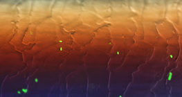 بكتريا الإشريكية القولونية الفلورية على شعرة