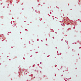 Gonorrhoea pathogen, Neisseria gonorrhoeae