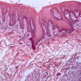 مقطع عرضي للسان البشري