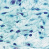 نسيج ليفي لين