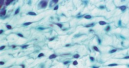 نسيج ليفي لين