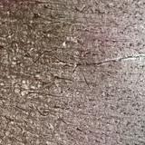 قشرة مخية بشرية، يمكن رؤية الطبقات الخلوية المختلفة