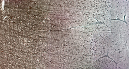 قشرة مخية بشرية، يمكن رؤية الطبقات الخلوية المختلفة