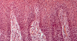 مقطع عرضي للسان البشري