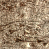 قشرة مخية بشرية، يمكن رؤية طبقة الخلايا الهرمية العملاقة