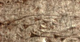 قشرة مخية بشرية، يمكن رؤية طبقة الخلايا الهرمية العملاقة