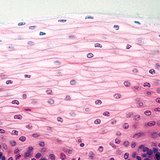 قشرة غير كاراتينية متعددة الطبقات