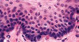 قشرة غير كاراتينية متعددة الطبقات