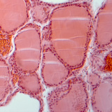 مقطع في الغدة الدرقية