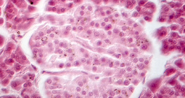 البنكرياس (صورة النقيض من المرحلة) - خلايا جزر لانغرهانس باهتة