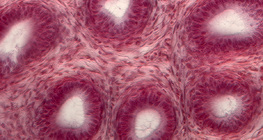 مقطع عرضي في الأنابيب المنوية