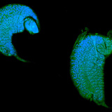 يرقة الدبور تتطور كطفيلي في خادرة ذبابة الفاكهة