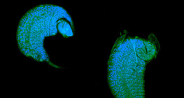 يرقة الدبور تتطور كطفيلي في خادرة ذبابة الفاكهة