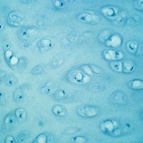 نسيج غضروفي