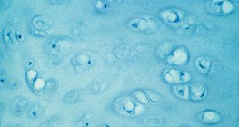 نسيج غضروفي