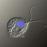 مرض المشعرات المهبلية (صورة نقيض فارق التداخل، نواة الخلية ملونة بالأزرق)