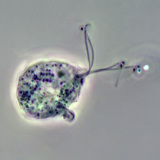 المشعرات المهبلية الممرضة (صورة للأطور المتباينة)