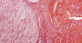 الغدة النخامية (مقطع طولي، تكبير منخفض)