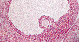 مقطع عرضي في المبيض (ثديات)