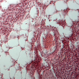 مقطع للرئة (إنسان)