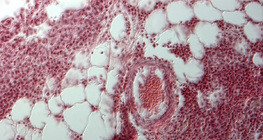 مقطع للرئة (إنسان)