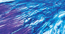 الاتصال بين العضلة و الوتر