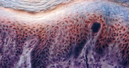 مقطع عرضي لجلد الإصبع عند الإنسان مع وجود مستقبلات داخله