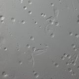 خلايا الدم لذبابة الفاكهة