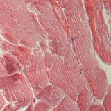 نسيج وتري (مقطع عرضي)