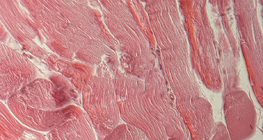 نسيج وتري (مقطع عرضي)