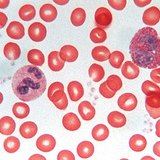 النسيج الدموي