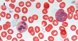 النسيج الدموي