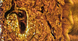 مقطع عرضي في جلد الإصبع البشري