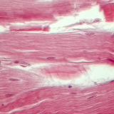 نسيج وتري (مقطع طولي)