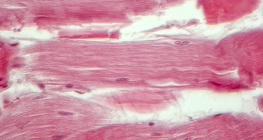 نسيج وتري (مقطع طولي)