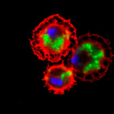 كريات دم ذبابة الفاكهة (باللون الأحمر) تلتهم البكتيريا (باللون الأخضر)