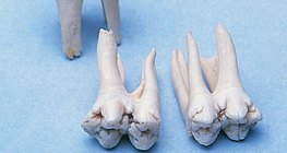 أضراس درنية