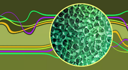الموجات الراكدة