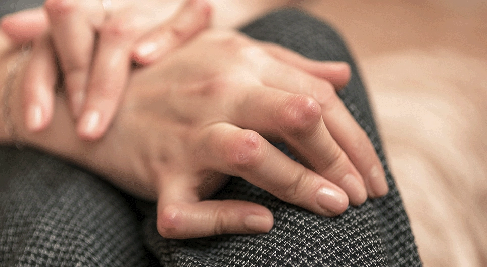 Autoimmune disorders of connective tissue