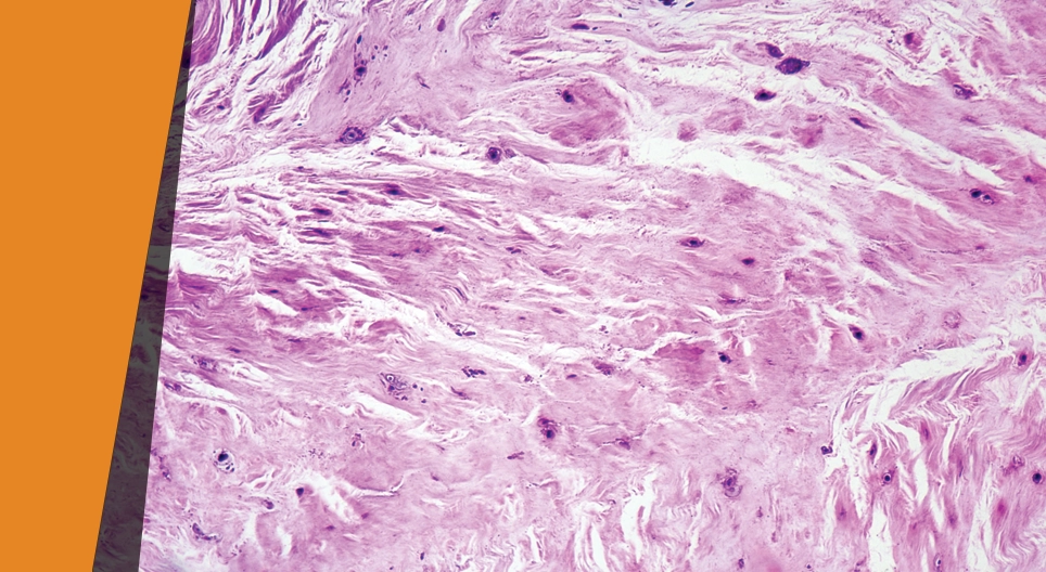 Lovitură controlată